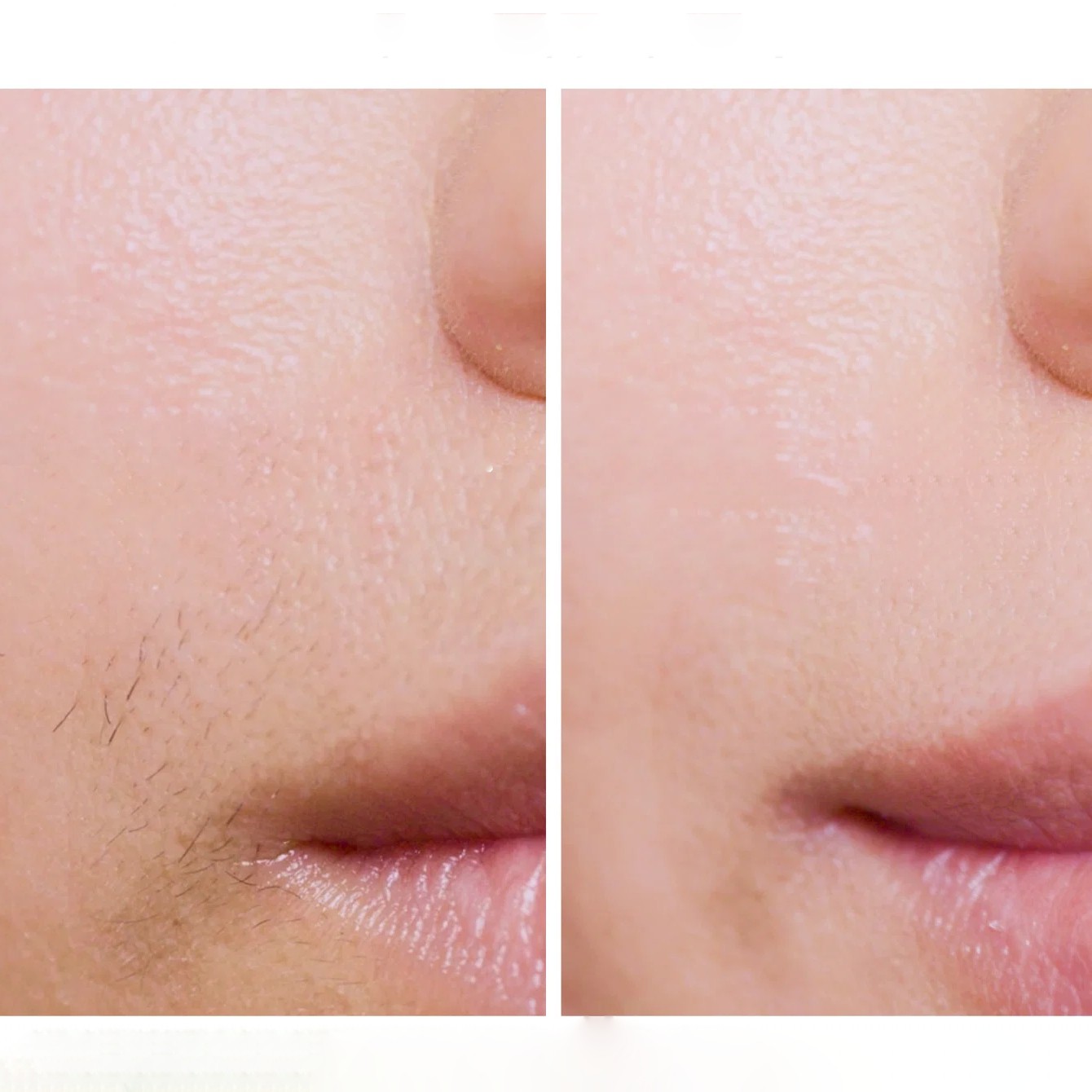Braun Skin i·expert PL7257 - najważniejsze zalety