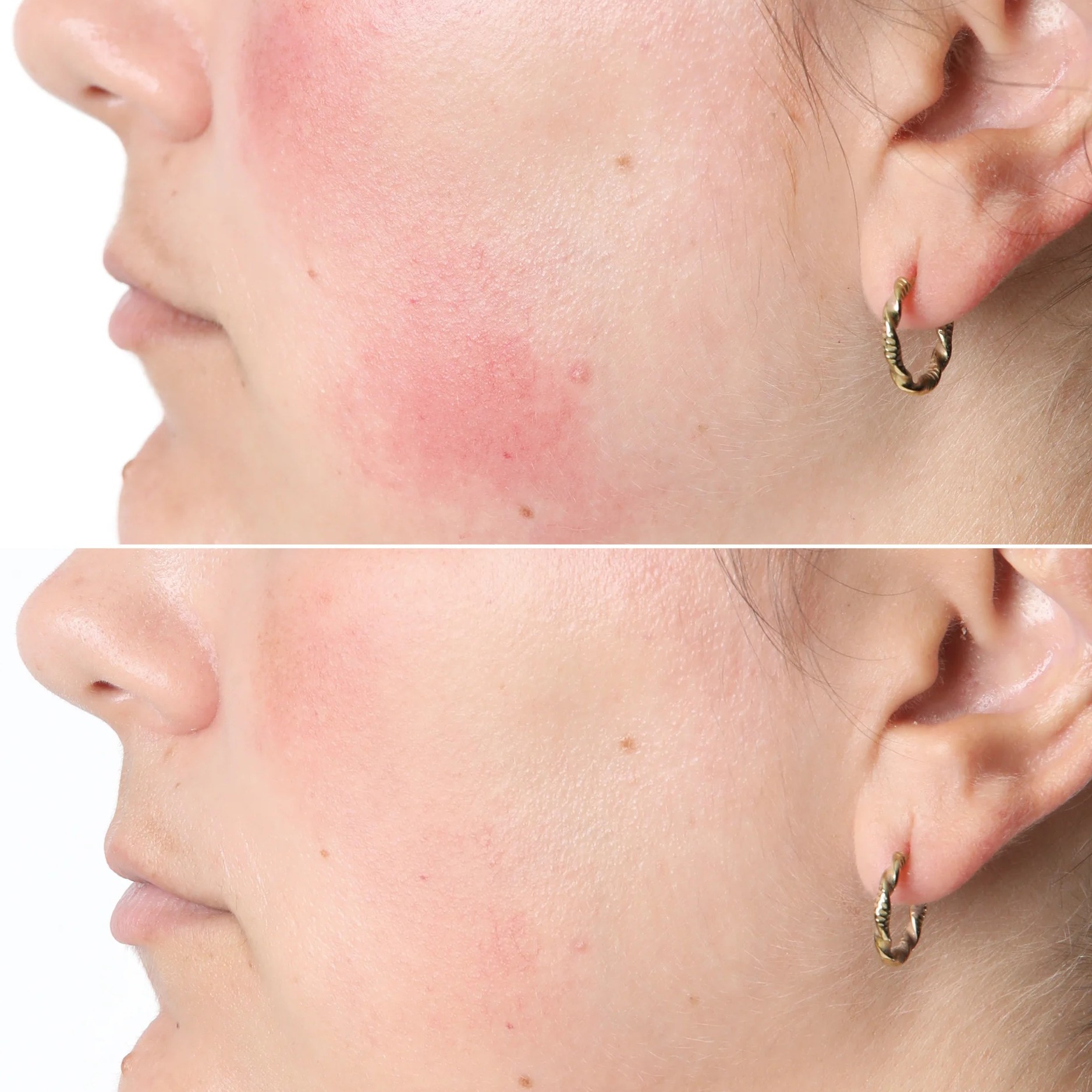Silk’n Facial LED Mask elastyczna konstrukcja
